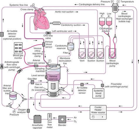 centrifugal pump system cardiopulmonary bypass|indications for cardiopulmonary bypass.